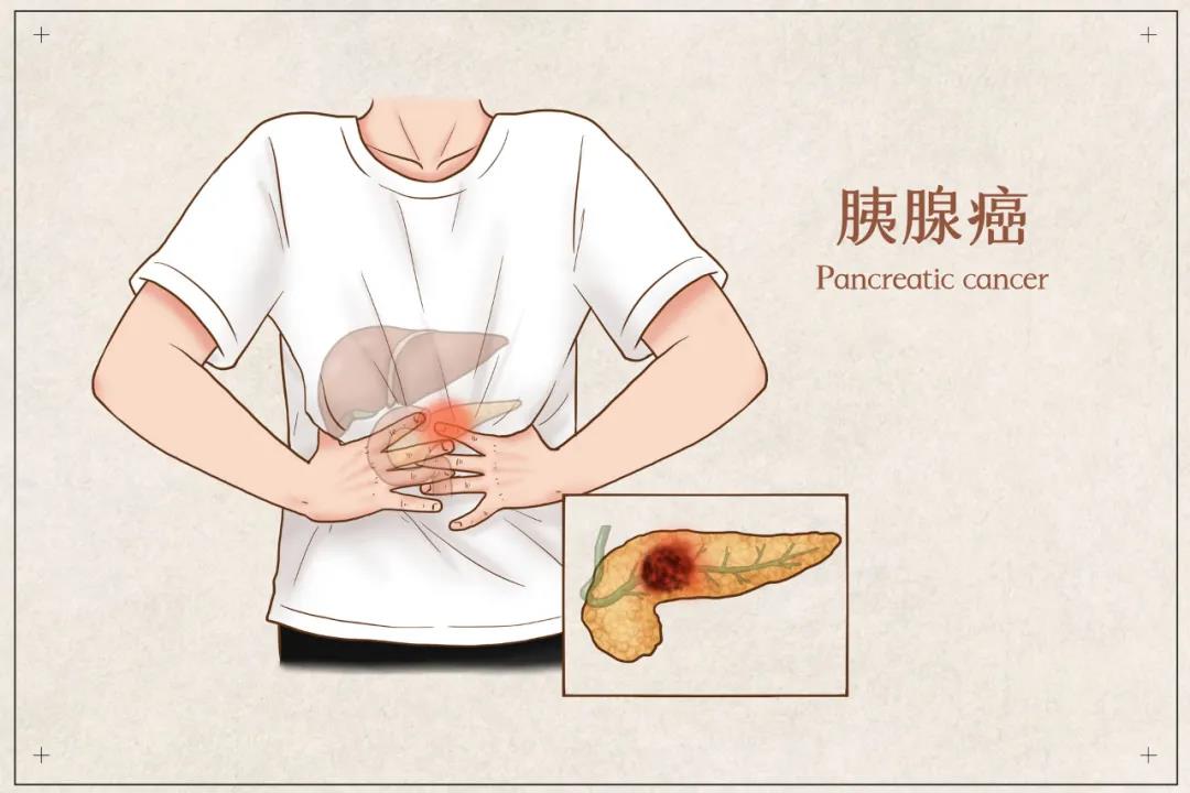 面對“癌王”，只能舉手投降？