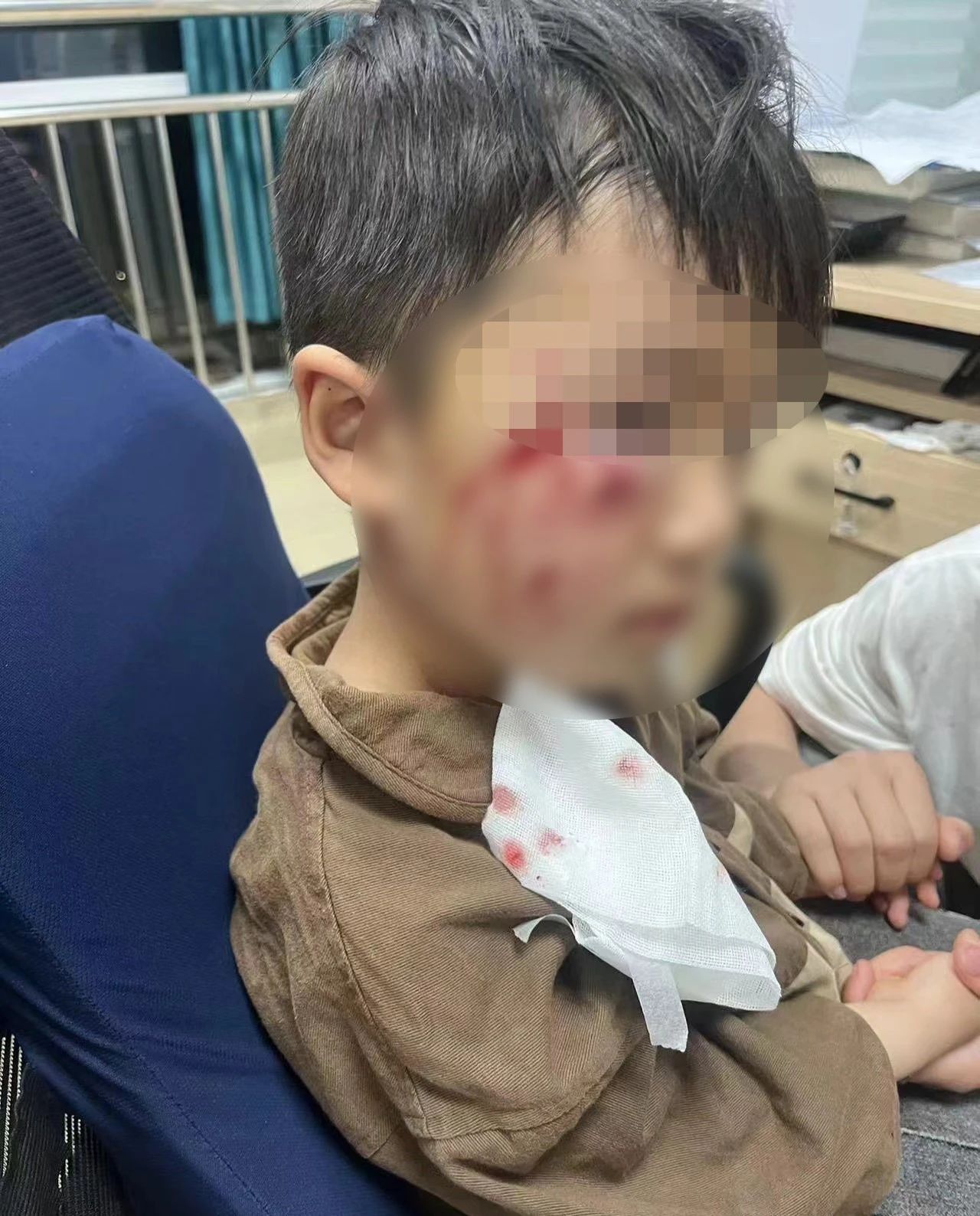 痛心！被咬傷18天后，3歲男童離世，母親發(fā)聲→